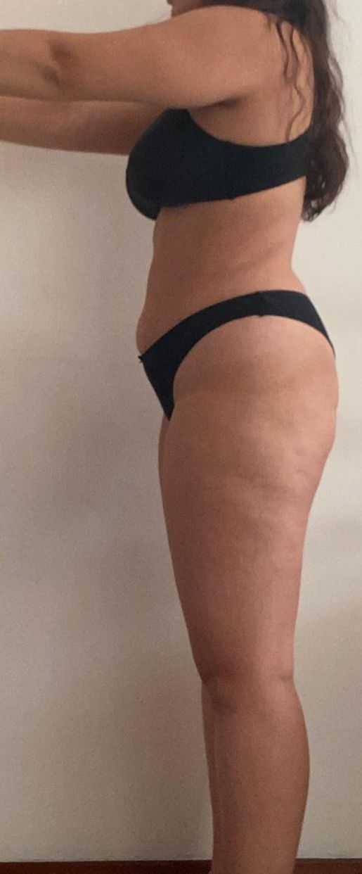 Dopo fisioterapia