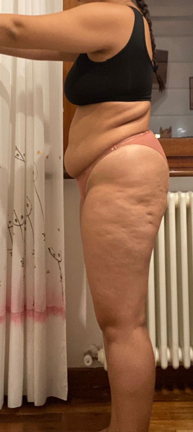 Prima fisioterapia
